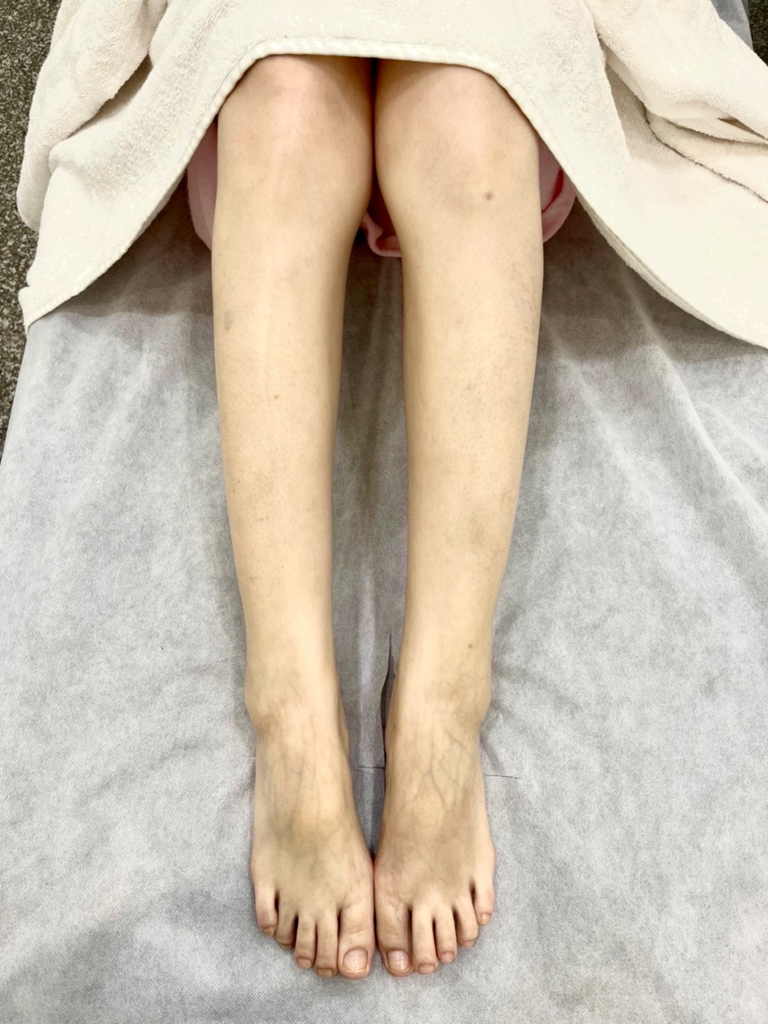 熱蠟除毛